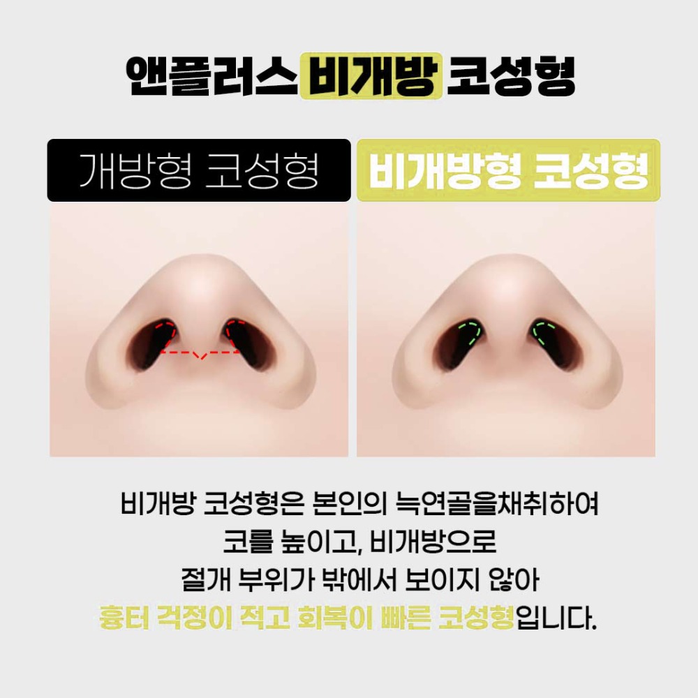 비개방3.jpg
